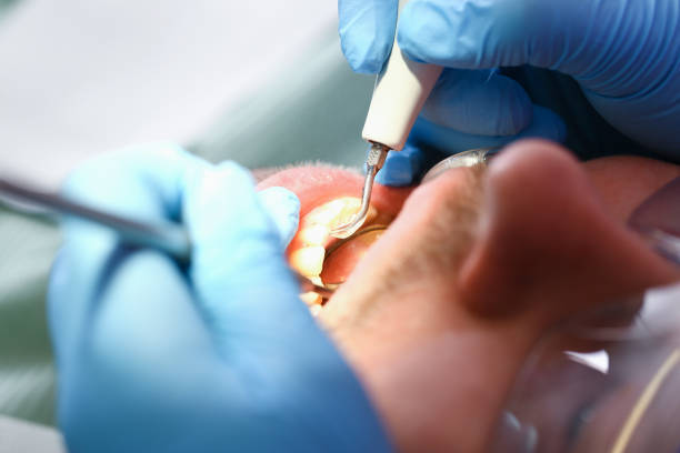 Best Urgent Dental Care for Toothaches in Parkersburg, WV